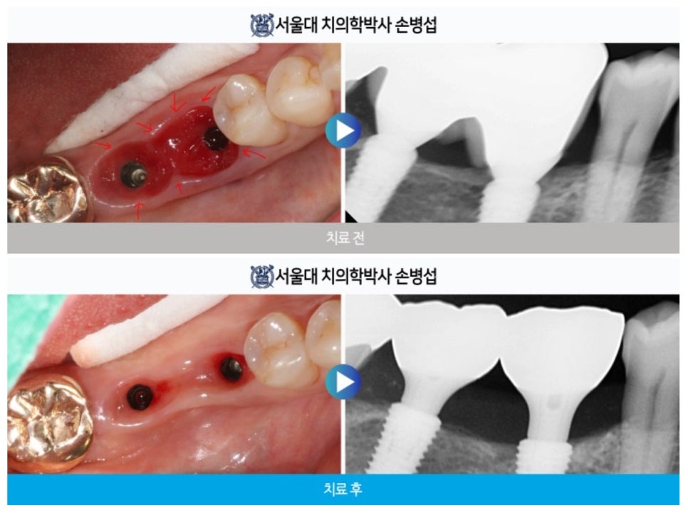 원장 직접 집도 장면
