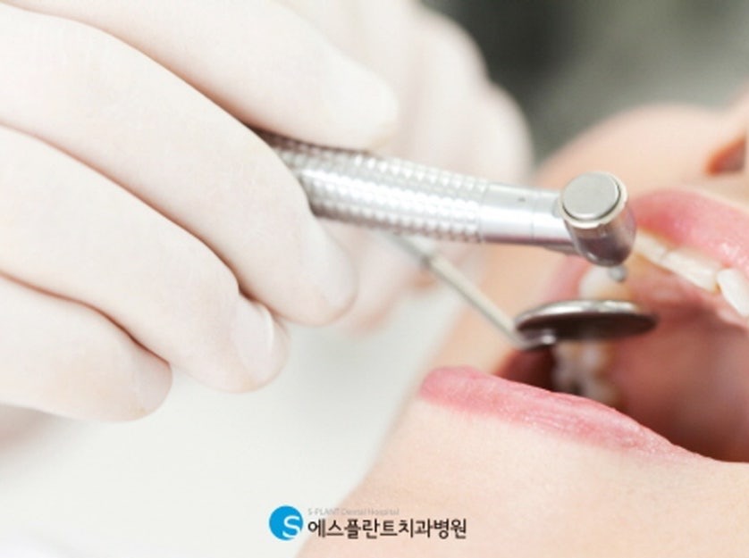 임플란트 치료 장면